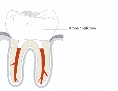 flyer_endodontischebehandlung_abb_5