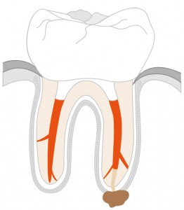 flyer_revisionsbehandlung_abb_1