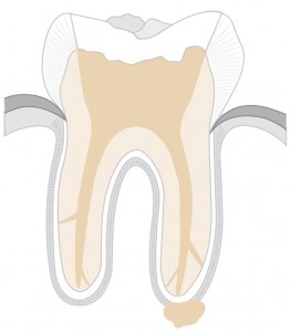 flyer_revisionsbehandlung_abb_3
